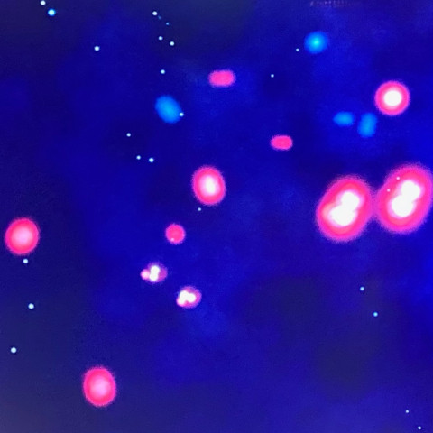 Das quadratische Bild zeigt pinkfarbene und blaue Flecken vor einem dunkelblauen Hintergrund. Innerhalb der pinken Flecken ist undeutlich eine Substruktur aus weißen Kugeln zu erkennen.